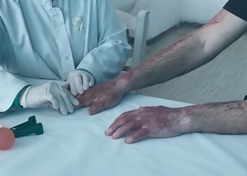 Општата болница – Кочани се соочува со недостиг од персонал, лекари специјалисти од Скопје ја почнаа евалуацијата на повредените во „Пулс“