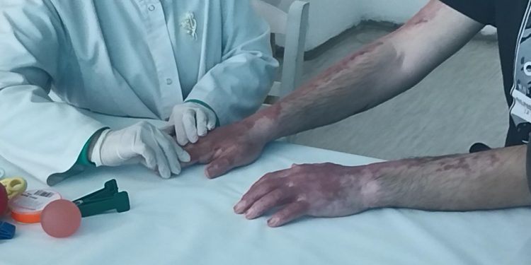 Општата болница – Кочани се соочува со недостиг од персонал, лекари специјалисти од Скопје ја почнаа евалуацијата на повредените во „Пулс“