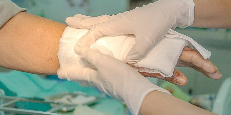 Просечен месечен трошок за третмани на еден повреден во „Пулс“ е над 40 илјади денари, семејствата сами се снаоѓаат за пари